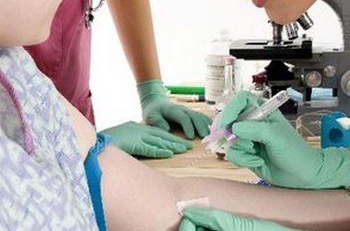 A blood is withdrawn from the left brachial artery to test for complete blood count.picture