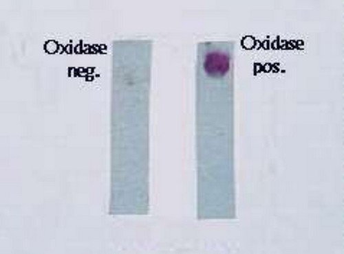 A comparison image of strips containing negative oxidase and positive oxidase.photo