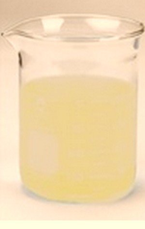 A urine that is cloudy and appears to be white in color.image