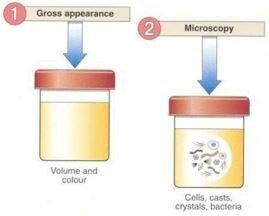 Two containers containing urine specimen.image