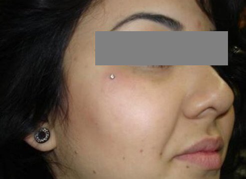 dermal-piercing-pictures