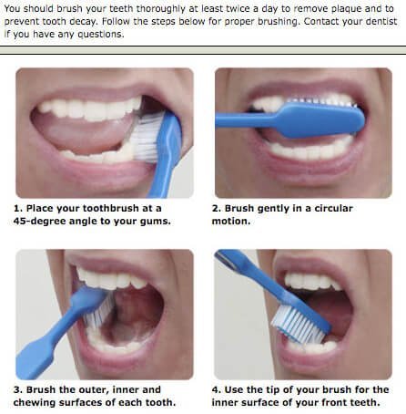 steps of brushing picture
